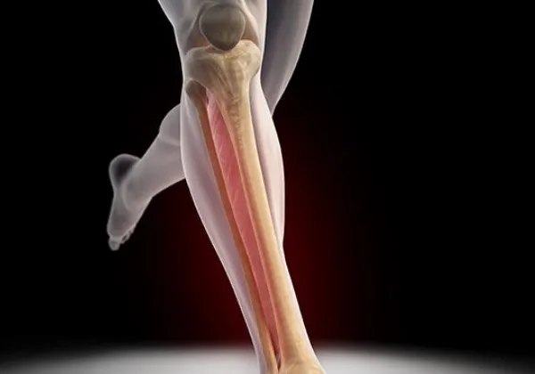 Anatomical illustration highlighting the muscles of the lower leg