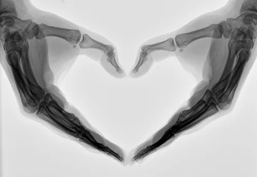 X-ray-style illustration of arms forming a heart shape