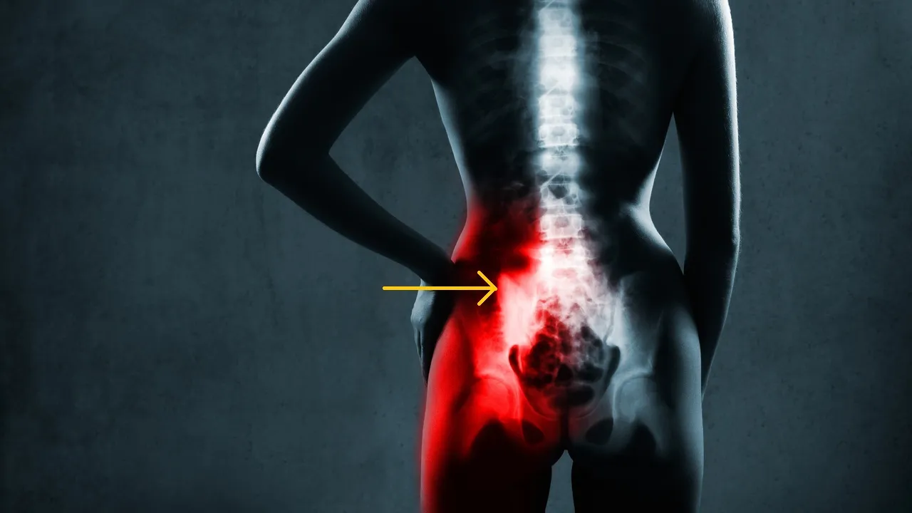 Illustration highlighting the lower back and sacroiliac area in red