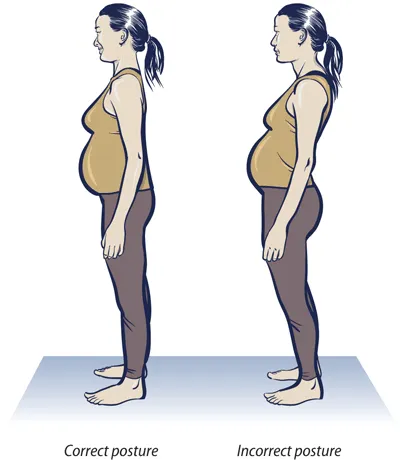 Illustration comparing two standing postures during pregnancy