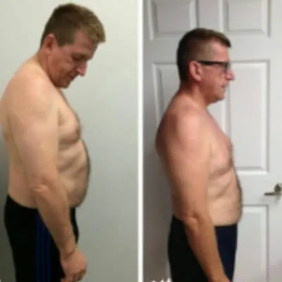 Side-view before-and-after photos of a male Konga member wearing glasses