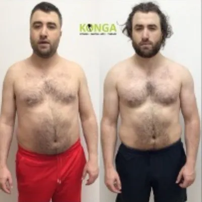 Front-view before-and-after photos of a male Konga member
